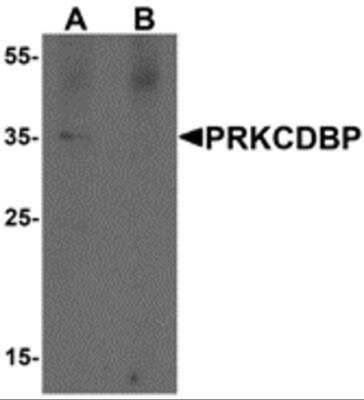 Western Blot: PRKCDBP AntibodyBSA Free [NBP2-81847]