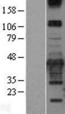 Western Blot: PRKCDBP Overexpression Lysate [NBL1-14773]