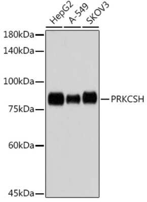 Western Blot: PRKCSH Antibody (4Z3K3) [NBP3-15318]