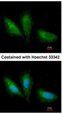 Immunocytochemistry/ Immunofluorescence: PRKCSH Antibody [NBP1-32006]