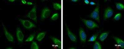 Immunocytochemistry/ Immunofluorescence: PRKCSH Antibody [NBP1-32006]