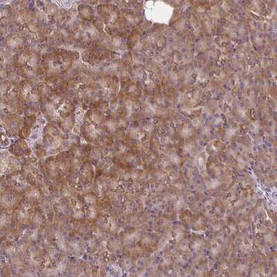 Immunohistochemistry: PRKCSH Antibody [NBP2-38492]