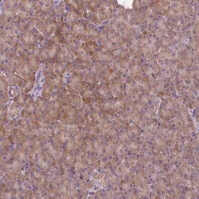 Immunohistochemistry: PRKCSH Antibody [NBP2-38511]
