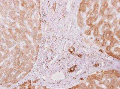 Immunohistochemistry-Paraffin: PRKCSH Antibody [NBP1-32006]
