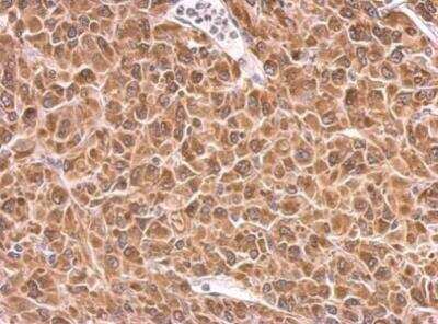 Immunohistochemistry-Paraffin: PRKCSH Antibody [NBP2-19931]
