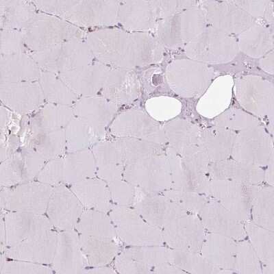 Immunohistochemistry-Paraffin: PRKCSH Antibody [NBP2-38492]