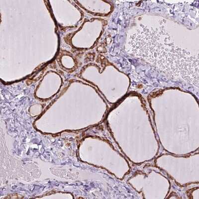 Immunohistochemistry-Paraffin: PRKCSH Antibody [NBP2-38492]