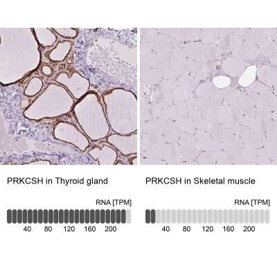 Immunohistochemistry-Paraffin: PRKCSH Antibody [NBP2-38492]