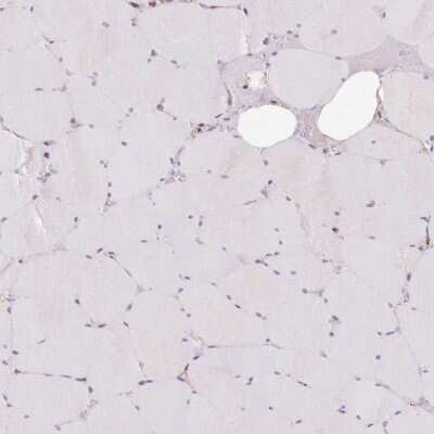 Immunohistochemistry-Paraffin: PRKCSH Antibody [NBP2-38511]