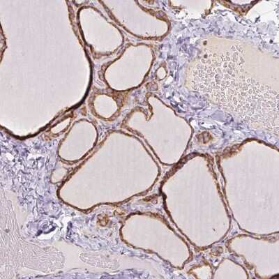 Immunohistochemistry-Paraffin: PRKCSH Antibody [NBP2-38511]