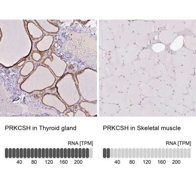 Immunohistochemistry-Paraffin: PRKCSH Antibody [NBP2-38511]