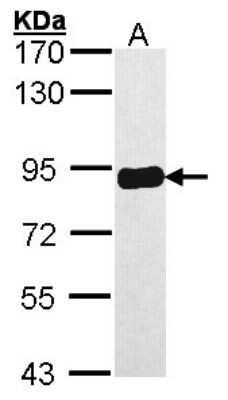 Western Blot: PRKCSH Antibody [NBP1-32006]