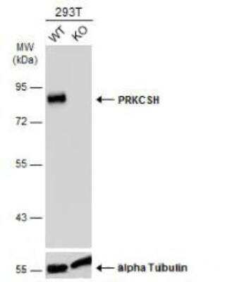 Western Blot: PRKCSH Antibody [NBP1-32006]