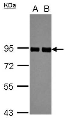 Western Blot: PRKCSH Antibody [NBP2-19931]