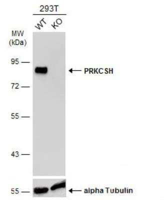 Western Blot: PRKCSH Antibody [NBP2-19931]