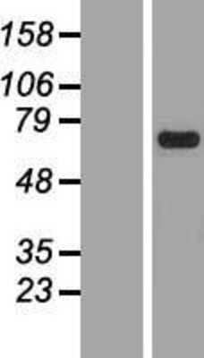 Western Blot: PRKCSH Overexpression Lysate [NBP2-08074]