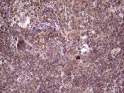 Immunohistochemistry: PRKD3/nPKC nu Antibody (OTI3D8) [NBP2-45390]