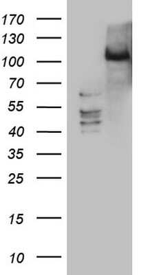 Western Blot: PRKD3/nPKC nu Antibody (OTI3D8) [NBP2-45390]