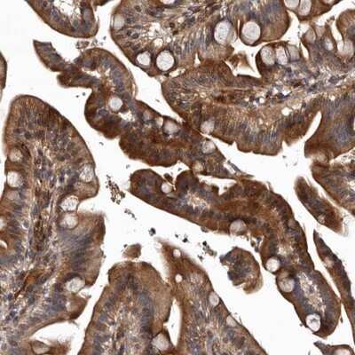 Immunohistochemistry-Paraffin: PRKD3/nPKC nu Antibody [NBP1-87948]