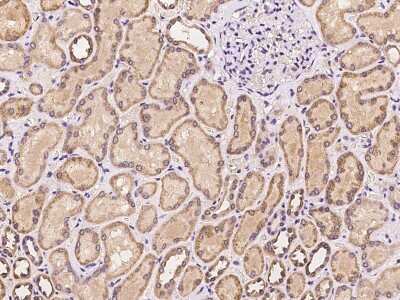 Immunohistochemistry-Paraffin: PRKD3/nPKC nu Antibody [NBP2-97269]