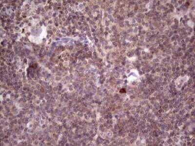 Immunohistochemistry: PRKD3/nPKC nu Antibody (OTI3D8) - Azide and BSA Free [NBP2-73595]