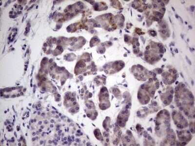 Immunohistochemistry: PRKD3/nPKC nu Antibody (OTI3D8) - Azide and BSA Free [NBP2-73595]
