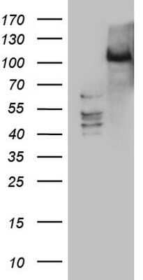 Western Blot: PRKD3/nPKC nu Antibody (OTI3D8)Azide and BSA Free [NBP2-73595]