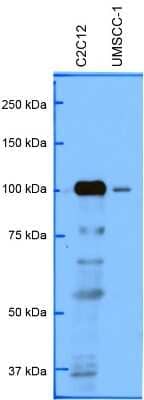 Western Blot: PRKD3/nPKC nu Antibody [NBP1-87948]