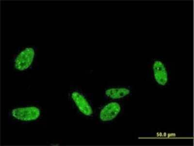 Immunocytochemistry/ Immunofluorescence: PRKRIP1 Antibody (1F6-3C2) [H00079706-M01]