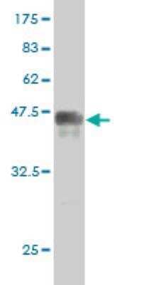 Western Blot: PRKRIP1 Antibody (3B11) [H00079706-M02]