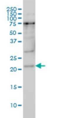 Western Blot: PRKRIP1 Antibody (4D11-3F11) [H00079706-M05]