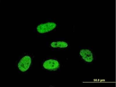 Immunocytochemistry/ Immunofluorescence: PRKRIP1 Antibody (M1) [H00079706-M07]