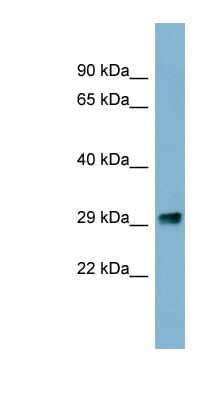 Western Blot: PRKRIP1 Antibody [NBP1-54890]