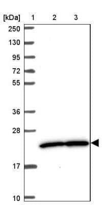 Western Blot: PRKRIP1 Antibody [NBP2-13811]