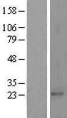 Western Blot: PRKRIP1 Overexpression Lysate [NBL1-14785]