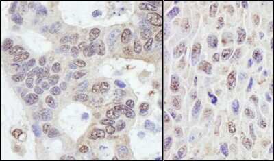 Immunohistochemistry: PRKRIR Antibody [NB100-1555]