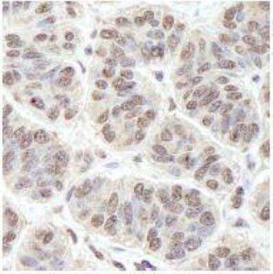 Immunohistochemistry-Paraffin: PRKRIR Antibody [NB100-1555]