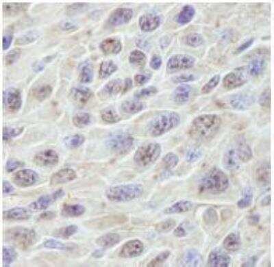 Immunohistochemistry-Paraffin: PRKRIR Antibody [NB100-1555]
