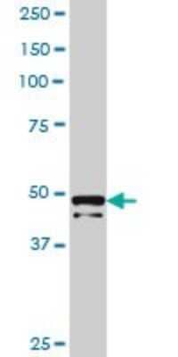 Western Blot: PRKRIR Antibody [H00005612-B01P]