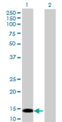 Western Blot: PRKRIR Antibody [H00005612-B01P]