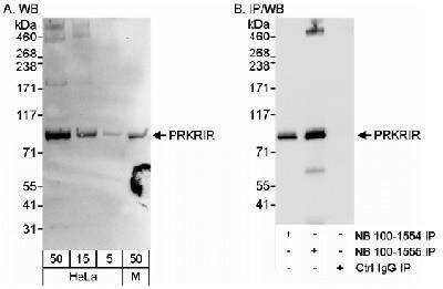 Western Blot: PRKRIR Antibody [NB100-1555]