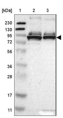 Western Blot: PRKRIR Antibody [NBP1-85312]