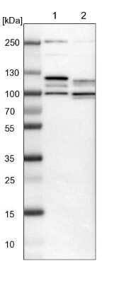 Western Blot: PRKRIR Antibody [NBP1-85312]