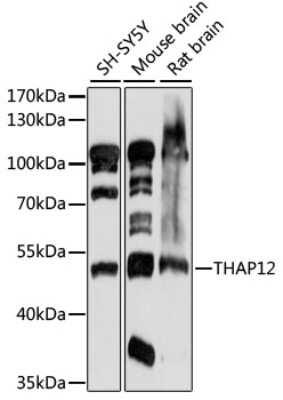 Western Blot: PRKRIR AntibodyAzide and BSA Free [NBP2-95091]