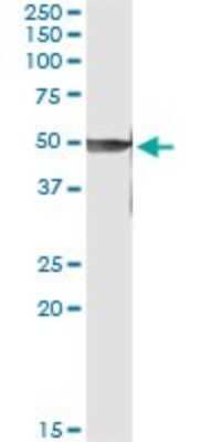 Immunoprecipitation: PRKX Antibody (1H7) [H00005613-M01]