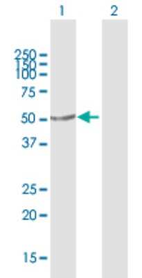 Western Blot: PRKX Antibody [H00005613-B01P]
