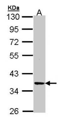 Western Blot: PRKX Antibody [NBP1-33469]