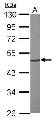 Western Blot: PRKX Antibody [NBP1-33469]