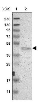 Western Blot: PRKX Antibody [NBP1-87267]