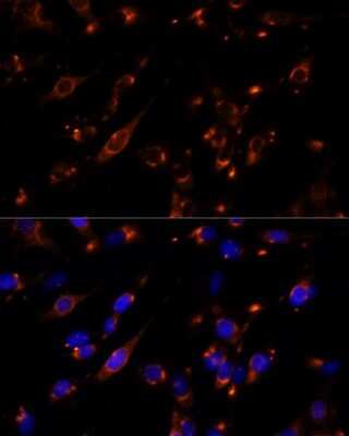 Immunocytochemistry/ Immunofluorescence: PRL-2/PTP4A2 Antibody - Azide and BSA Free [NBP2-93937]